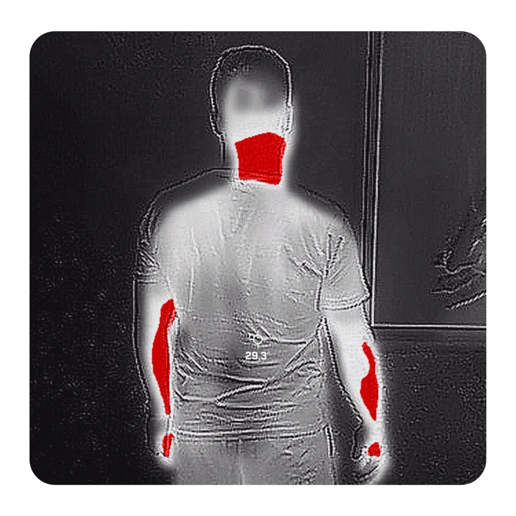 Imagem térmica mostrando em vermelho os pontos de inflamação na cervical e nos flancos